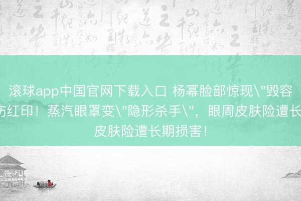 滚球app中国官网下载入口 杨幂脸部惊现